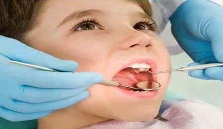 خدمات دندانپزشکی تحت پوشش بیمه سلامت افزایش یافت